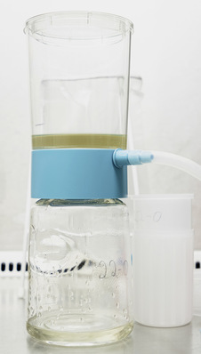 Erster Aufbereitungsschritt im Labor ist das Filtrieren