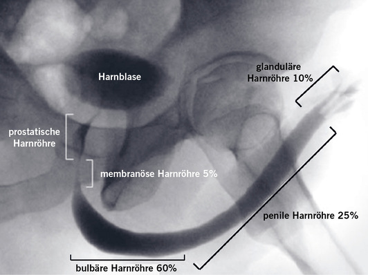 Abb. 1:    Zysturethrogramm einer gesunden Harnröhre mit Darstellung der anatomischen Abschnitte und Angabe der prozentualen Häufigkeit der Strikturen (mod. nach Tritschler et al. 2013a)