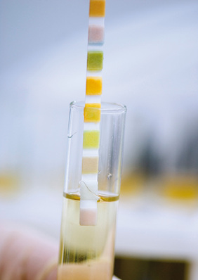 
Urinschnelltests: Müssen Arbeitsmediziner in Zukunft Kontrolllösungen mitführen?
