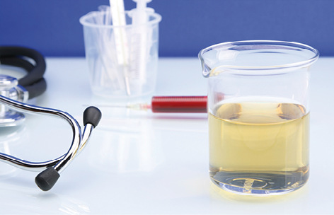 



Arbeitsmedizinisches bio-logisches Monitoring geht über die reine Bestimmung von Gefahrstoffen oder Gefahrstoffmetaboliten in Blut, Urin oder anderen biologischen Medien hinaus
