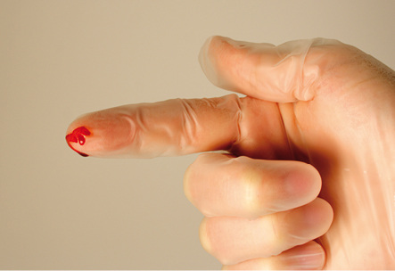 



Nadelstichverletzungen und deren Folgen sind das Thema des aktuellen CME-Falles
