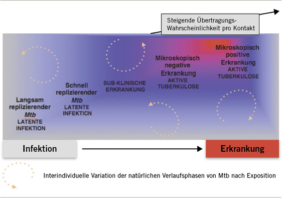 
 Abb. 1: 
 Spektrum der Tuberkulose nach Infektion. Es handelt sich dabei nicht um einen linear progressiven Prozess. Patienten können jederzeit in einer Phase verbleiben oder sehr schnell von einer Phase in die nächste fortschreiten
